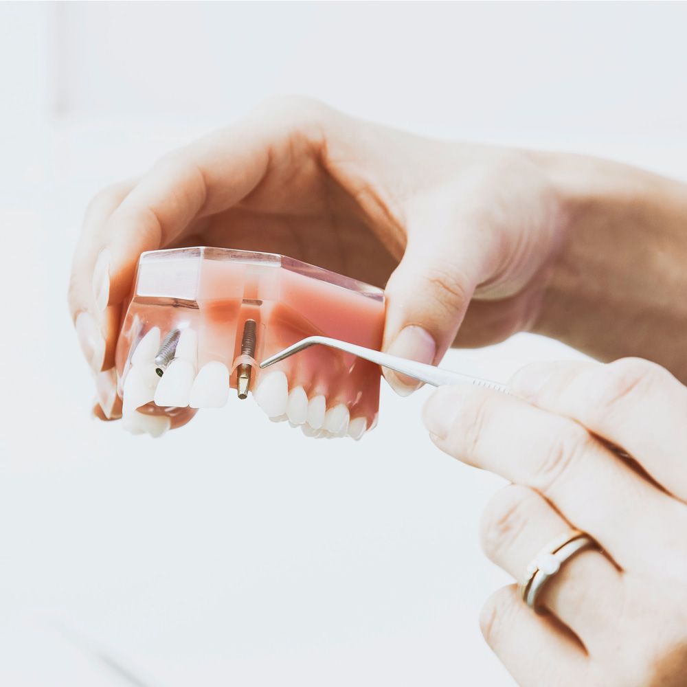 Demonstration of implant placement with model of jaw